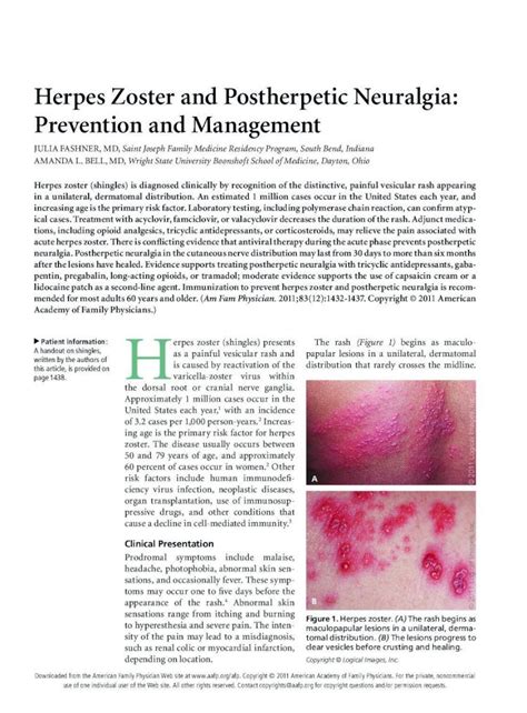 cibi dopo hermes zoster|Herpes Zoster and Postherpetic Neuralgia: Prevention and .